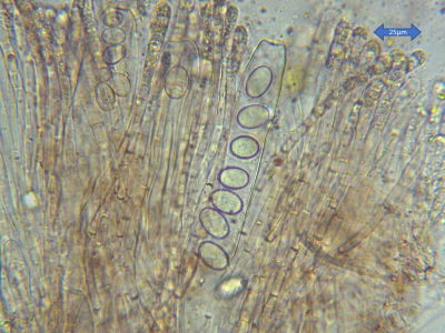 Iodophanus carneus microscopy March 2021
